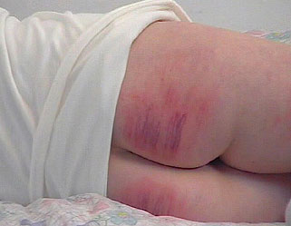 Dressed For Pain - Pure Spanking Videos